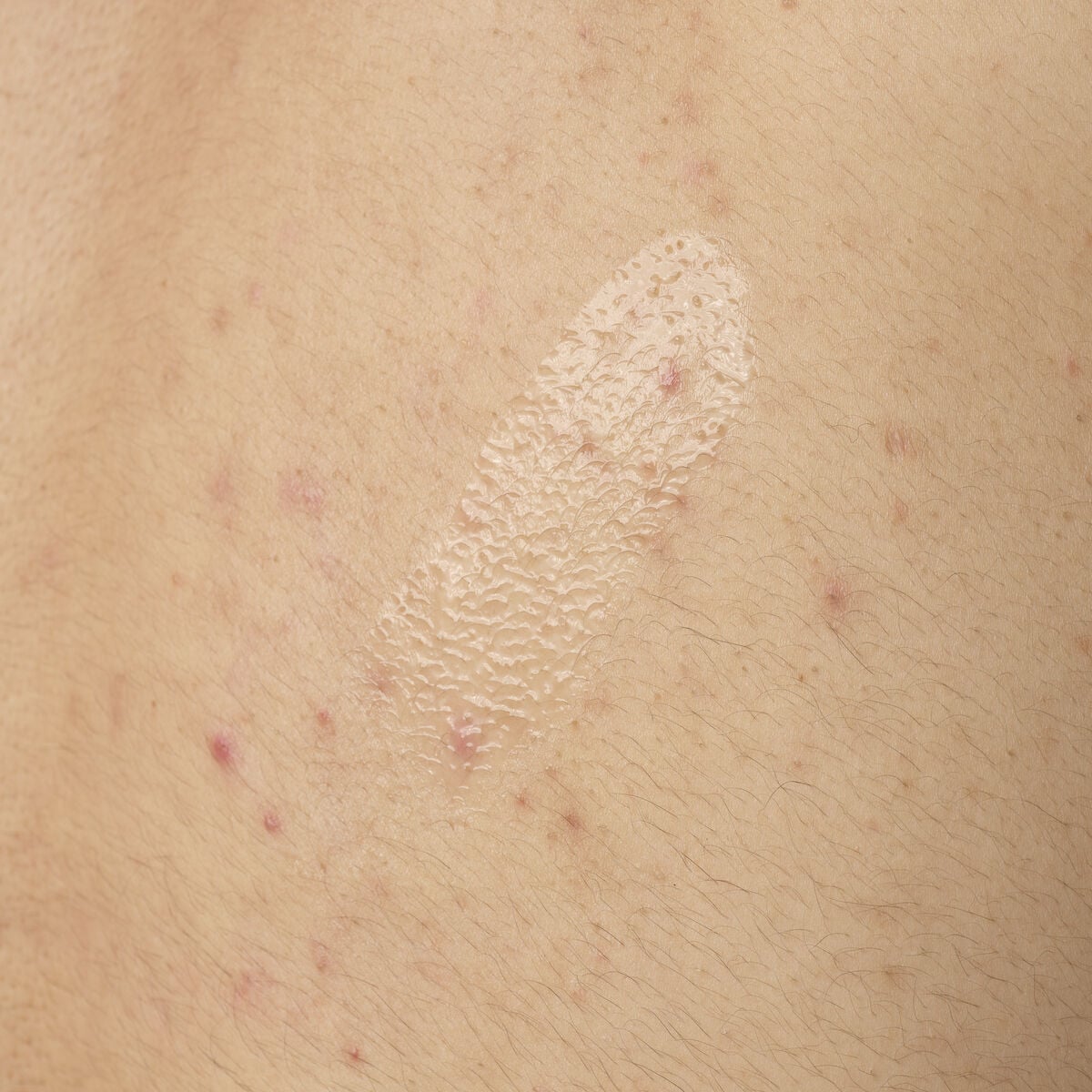 salicylic-acid-0-5-body-serum-p5 ORD-salicylic-acid-05-body-240ml-application.jpg