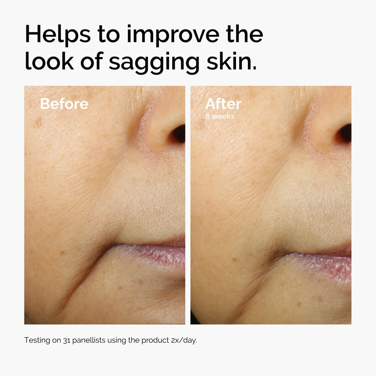 caffeine-3-escin-1-face-serum-s0 ord-caffeine-3pct-escin-1pct-face-serum-before-after-sagging.jpg