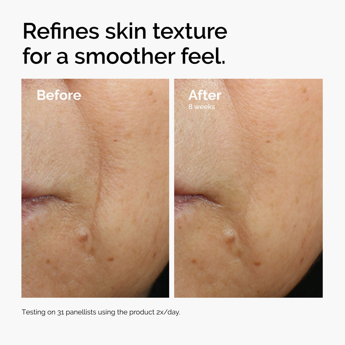 caffeine-3-escin-1-face-serum-s0 ord-caffeine-3pct-escin-1pct-face-serum-before-after-texture.jpg