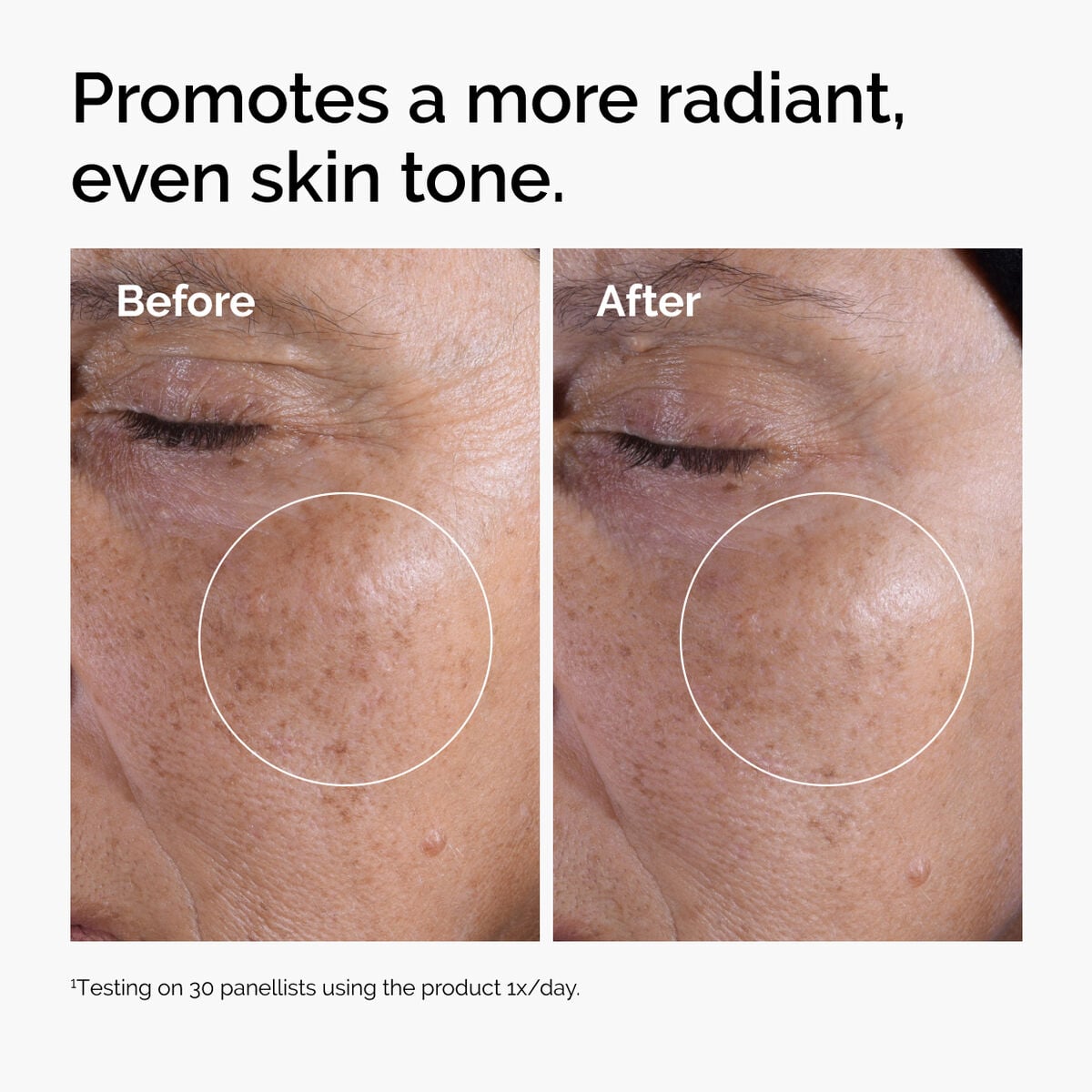 glycolic-acid-7-exfoliating-toner-y9 ord-glycolic-before-after-radiance.jpg