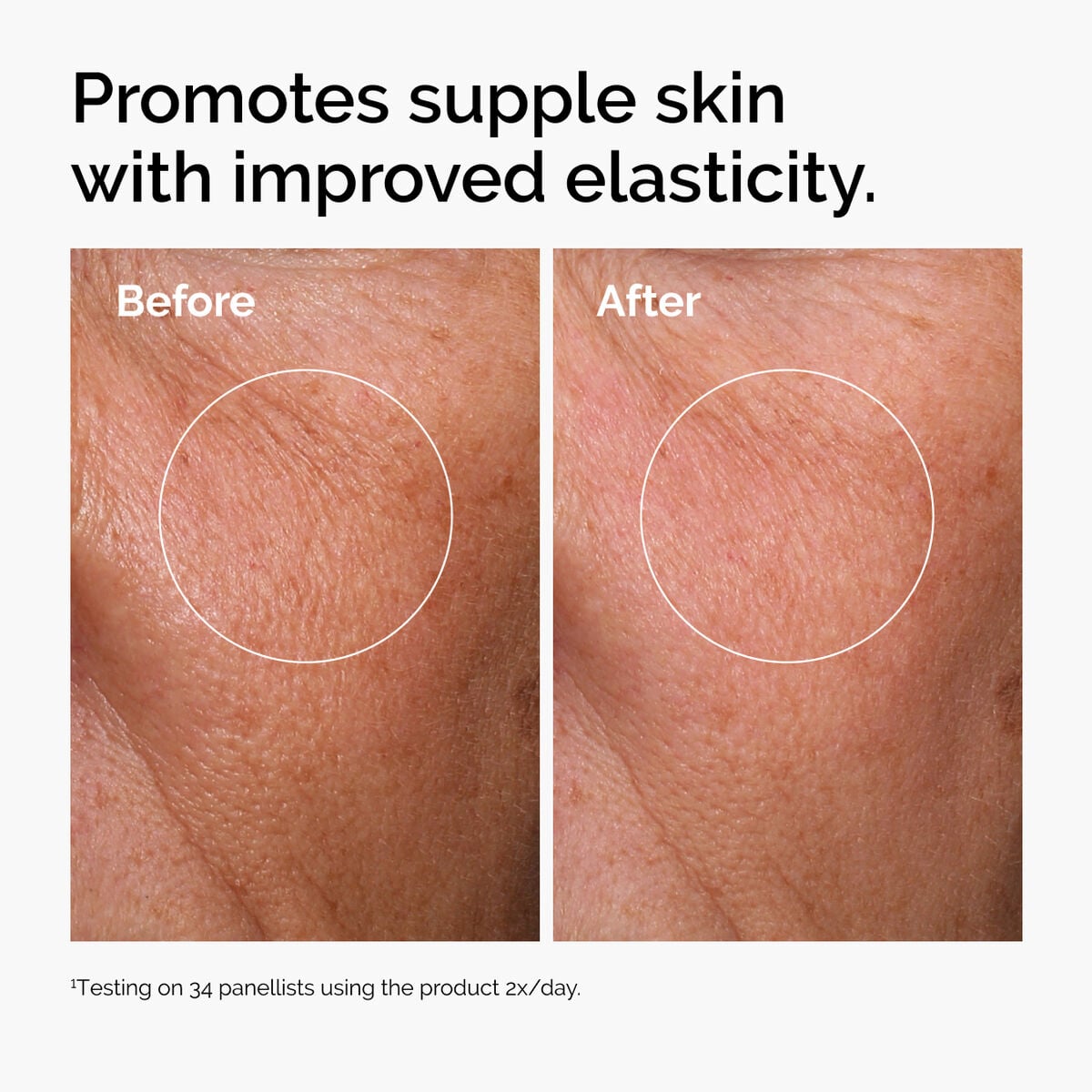 hyaluronic-acid-2-b5-with-ceramides-s4 ord-hyaluronic-acid-2pct-b5-hydrating-serum-before-after-elasticity.jpg