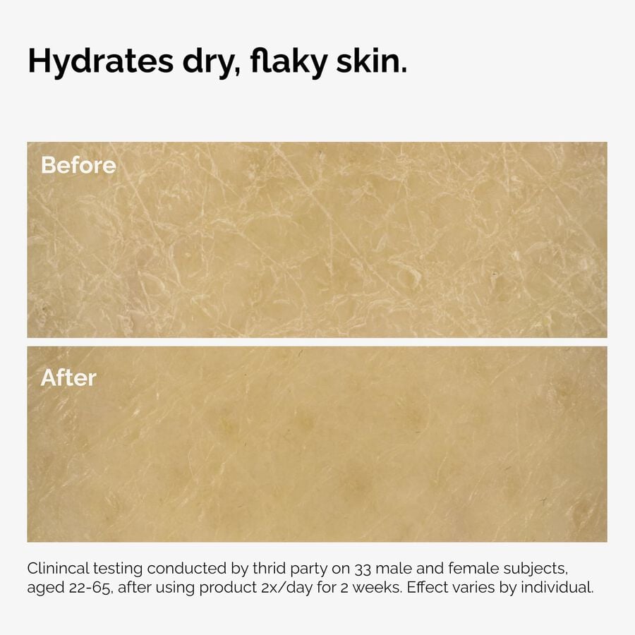 the-body-care-collection-t3 ord-natural-moisturizing-factors-inulin-body-before-after-graphic-02.jpg