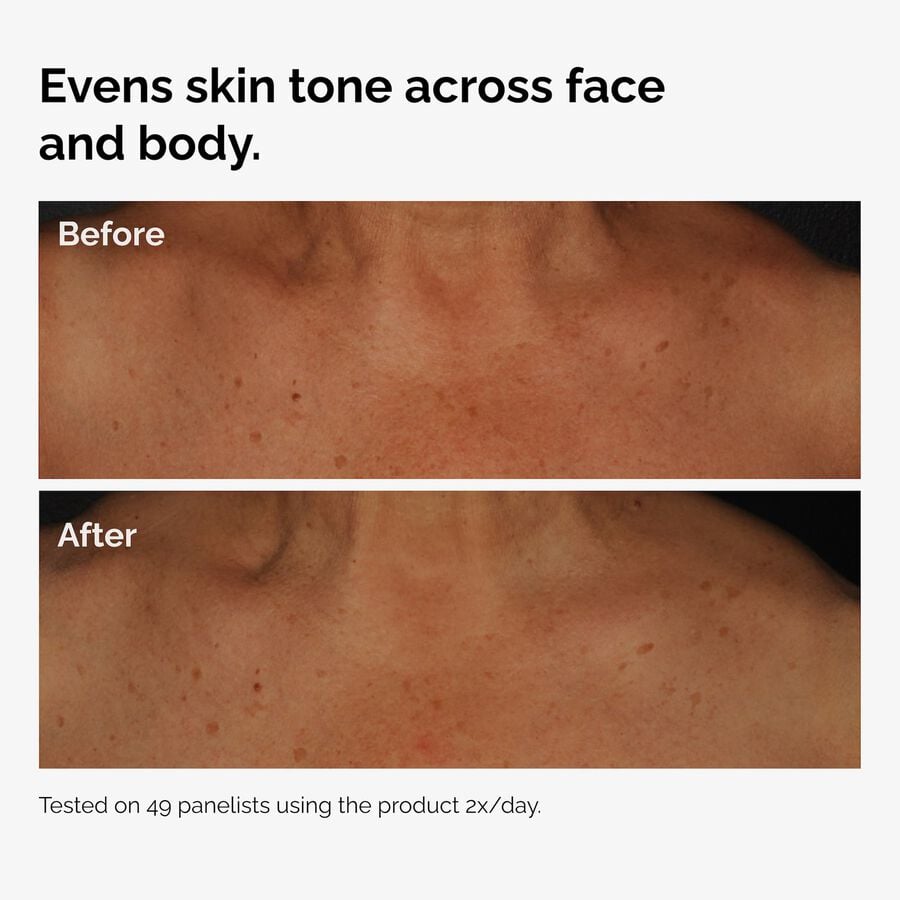 the-body-care-collection-t3 ord-niacinamide-face-body-serum-before-after-even-tone-graphic.jpg