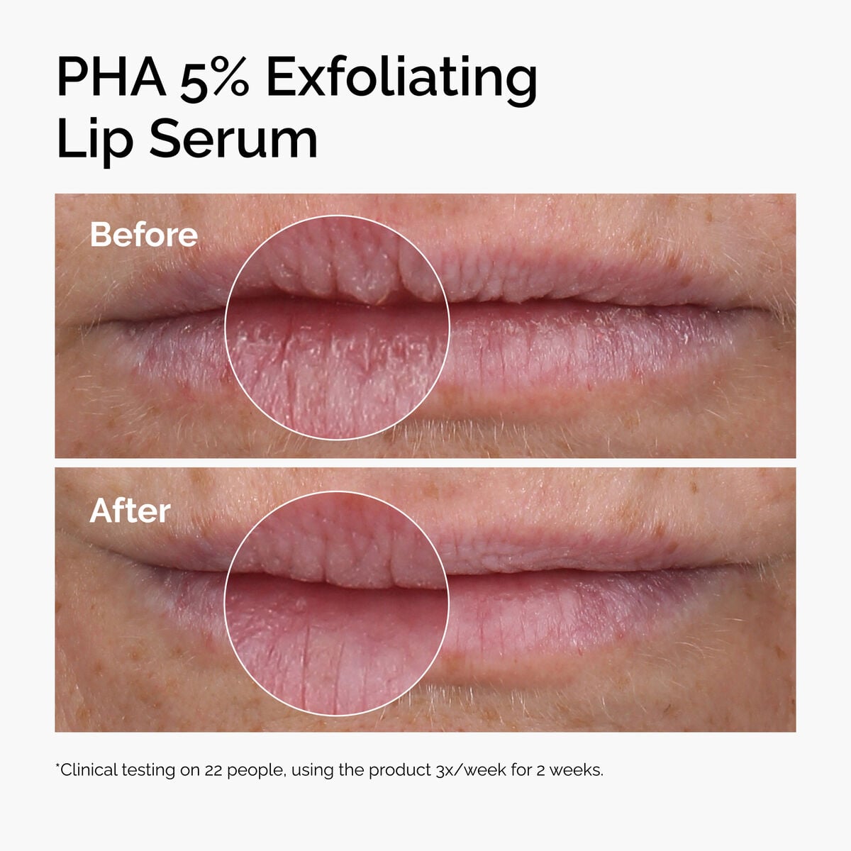 pha-5-exfoliating-lip-serum-c5 ord-pha-5pct-lip-exfoliating-serum-before-after.jpg