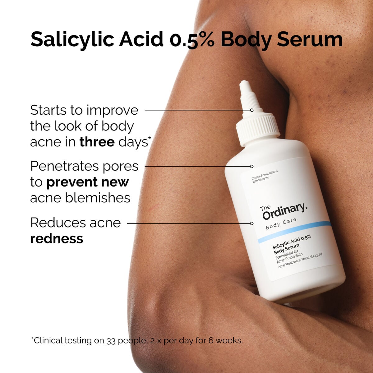 salicylic-acid-0-5-body-serum-p5 ord-salicylic-05-body-serum-otc-benefits-infographic.jpg