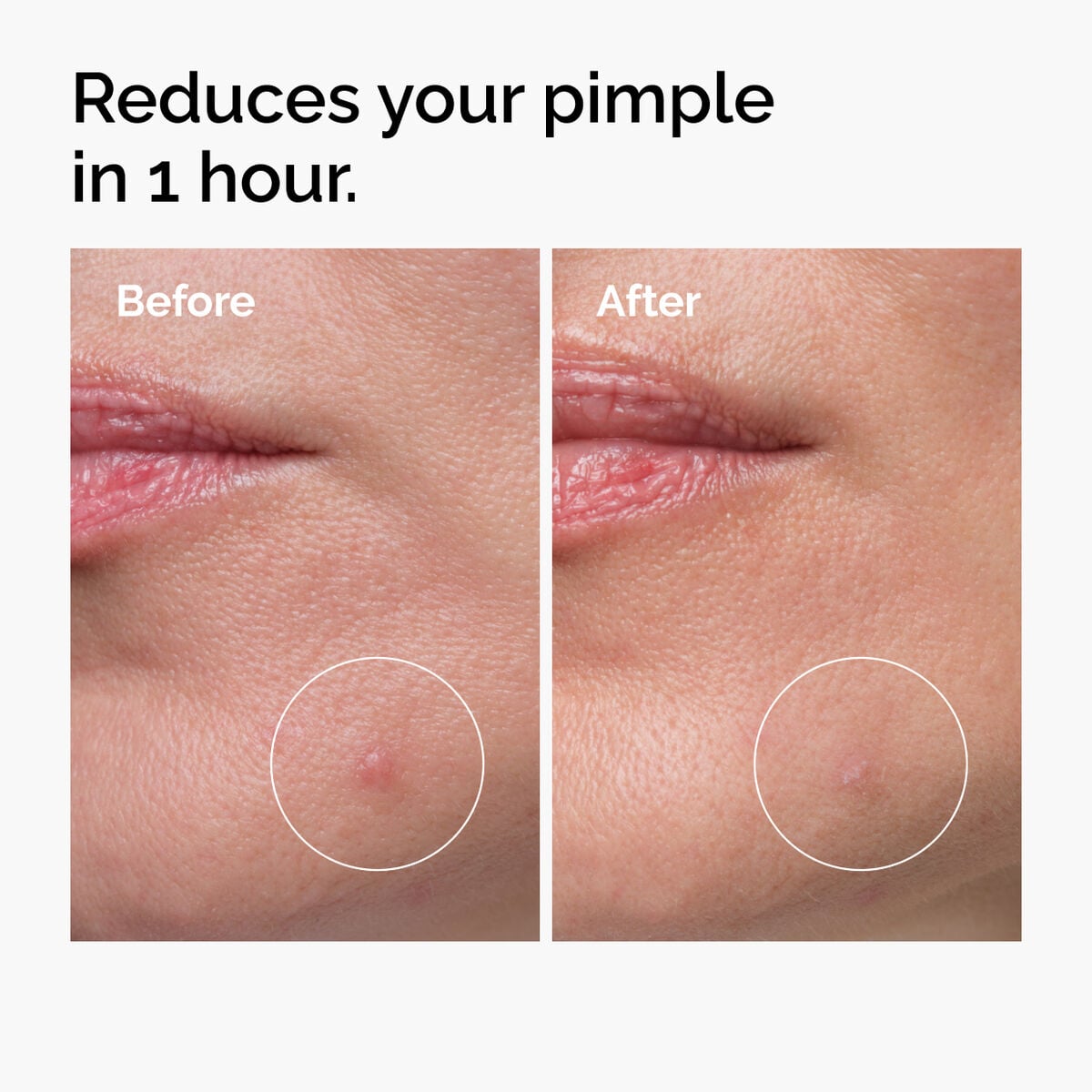 sulfur-10-powder-to-cream-concentrate-j2 ord-sulfur-10pct-powder-to-cream-concentrate-before-after-NA.jpg